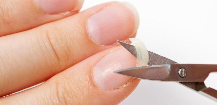 ongles cassants